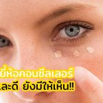 คอนซีลเลอร์ยี่ห้อไหนดี